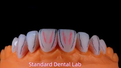 Standard Dental Lab Co., Limited 製造者の生産ライン