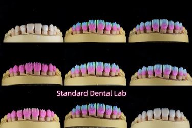 Standard Dental Lab Co., Limited 製造者の生産ライン
