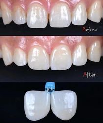 Standard Dental Lab Co., Limited 製造者の生産ライン