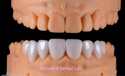 Standard Dental Lab Co., Limited 製造者の生産ライン