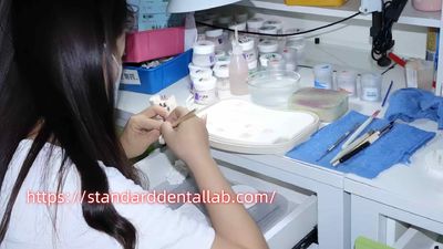 Standard Dental Lab Co., Limited 製造者の生産ライン