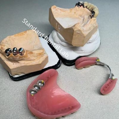 購入 高級エステティック CAD CAM 歯 部分 歯入れ 歯入れ スタンダード 歯科 検査室 オンライン製造