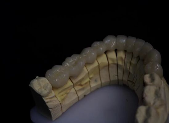 購入 層状のポルセラン 溶融ジルコニア オンライン製造