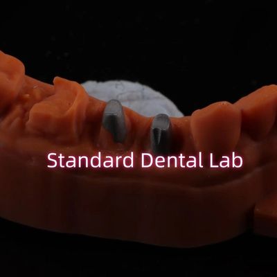 購入 メタル・ポスト・コア・クラウン CAD CAM ポルセラン/ジルコニア コッピング フル・ジルコニア・ブルキアー・クラウン オンライン製造