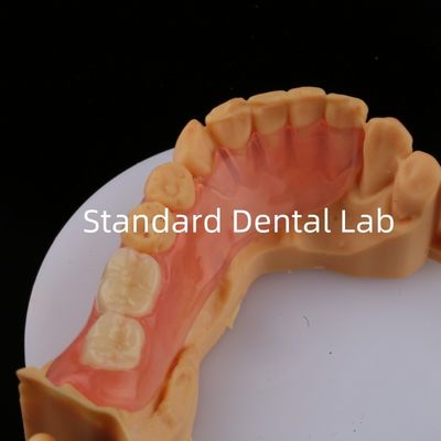 購入 アース歯 ピンク/ダーク TCS バルプラスト 柔軟な部分歯入れ 高美容性 歯科3Dプリントモデル オンライン製造