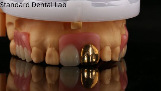 購入 黄金歯のフルアクリル歯入れ/歯科一時的なアクリル歯入れ イボクラ プロフェッショナル FDA 承認 オンライン製造