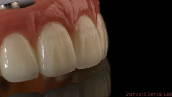 購入 プロジルコニア 歯科インプラント 冠 タイタン CAD CAM ジルコニア 冠 中国 歯科ラボ オンライン製造