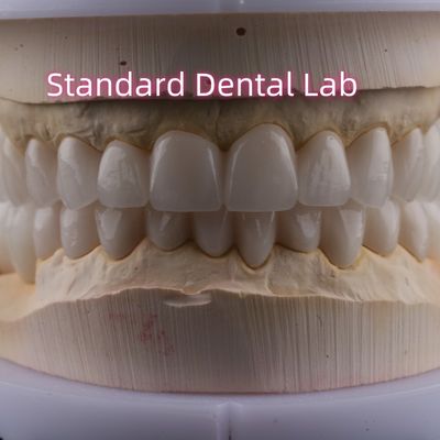 歯科研究室 フルアーチ ジルコニア ポルセラン クローネ PFZ クローネ ISO FDA CE