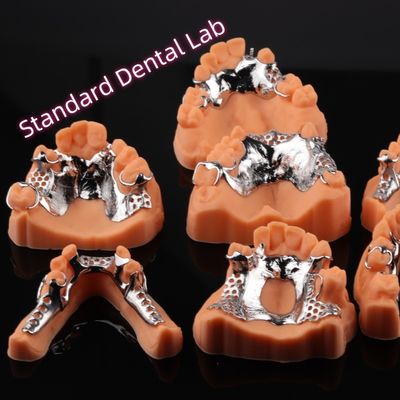 CAD CAM 取れる部分歯入れ メタルフレーム 3Shape エキソカド 歯入れデザイン