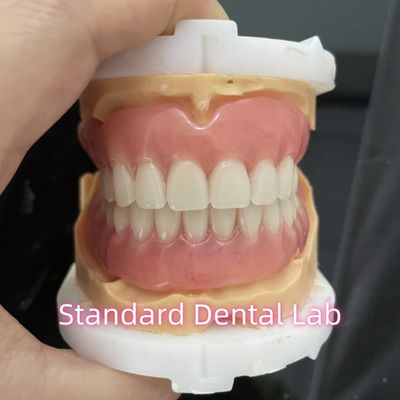 OEM 標準歯科ラボ 抜ける歯科 入れ替えが簡単