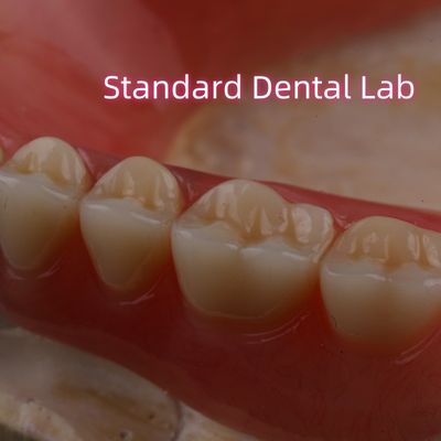 SDL 熱固化 アクリル 部分歯入れ イボクラ歯 歯科ラボ 高精度