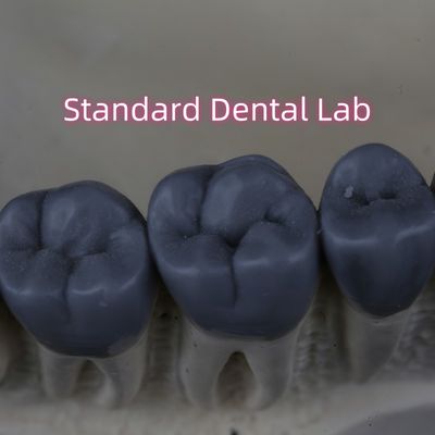 プロのデジタル歯科ラボ ワックスアップ3形 FDA承認