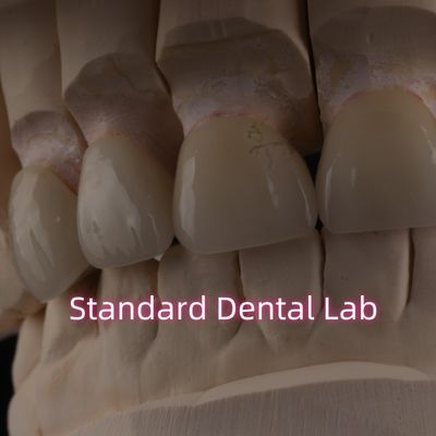 プロの歯科ラボ 固定修復のためのジルコニアの冠