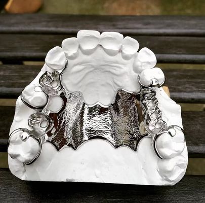 コバルトクロム 取れる部分歯入れのフレーム レーザー印刷