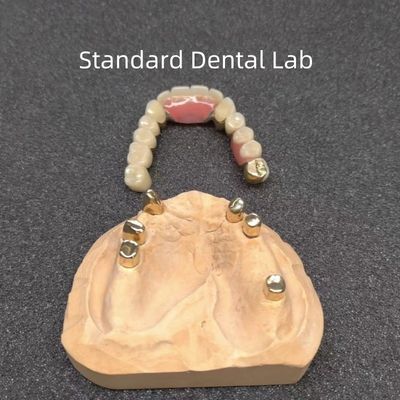 CAD CAM 歯 部分 歯入れ 歯科 プロフェッショナル 正確