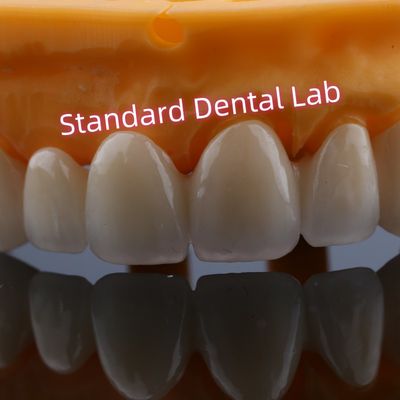 前部 の 修復 欠損 し た 歯 の ため の ジルコニア の 橋 の 冠