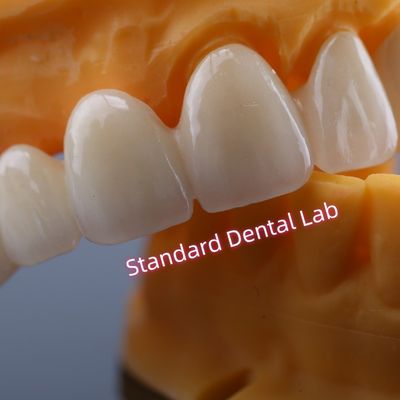 CAD CAM ミール ジルコニア クラウン ブリッジ 高度な生物互換性