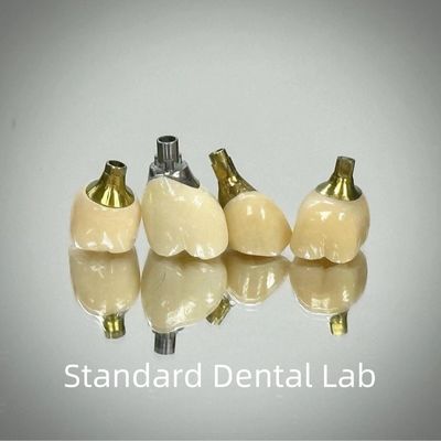 専門的なジルコニア スクリュー 固定インプラント 冠 タイタン CAD CAM