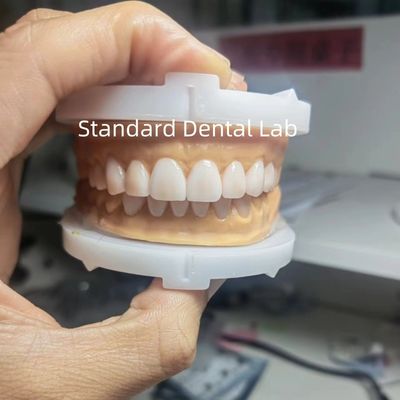 中国歯科ラボの歯磨き粉を使用する歯科専門家のための仮用ワックスアップ
