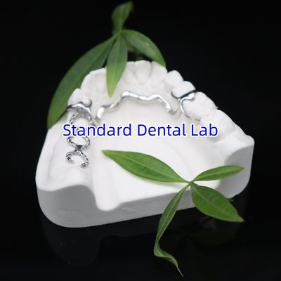 ビタリウム2000部分枠 ISO CEとFDA 中国歯科ラボ金属枠 部分歯入れ