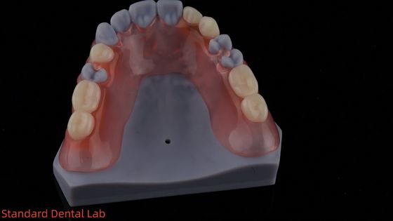 3Dプリントモデル 高エステティック 歯科 TCS バルプラスト 柔軟性のある部分歯科 歯科ラボ