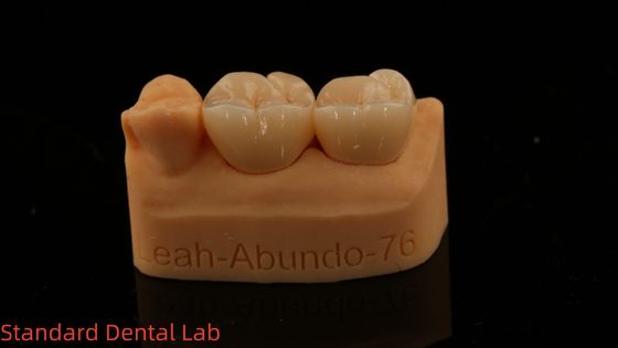 固形歯科ラボクラウン 3Dプロ 高透明度フルジルコニアクラウン 5年保証