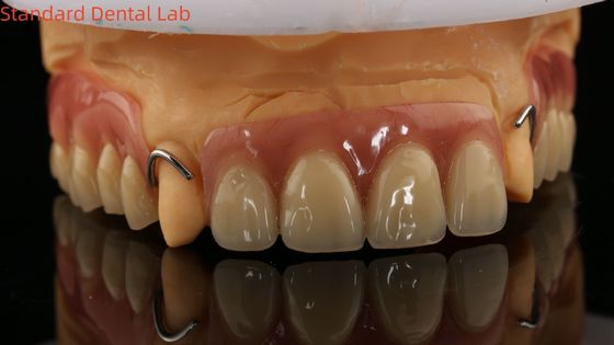熱固化 イボクラ 部分アクリル 歯科 歯科 検査室 3D プリントモデルで高精度