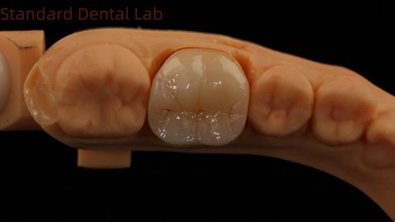 歯科 デジタル フルジルコニア クラウン ノリテーク ポルセラン 3D プリントモデル 5 年間の保証