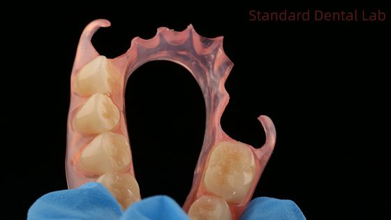 歯科 TCS バルプラスト 柔軟性のある部分歯入れ 歯科ラボ 3Dプリントモデル 高級エステティック