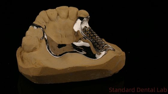 高強度 3D プリント 鋳造枠 COCR 部分歯科 クロム コバルト 鋳造金属枠