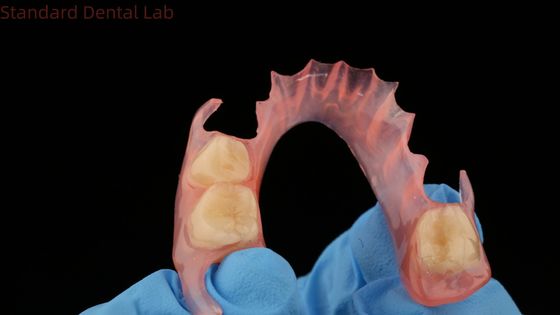 3Dプリントモデル 歯科 TCS バルプラスト 柔軟性のある部分歯科 ピンク/ダークカラー 歯科ラボ製品