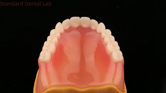 完全歯科 イボクラール 完全歯科 アクリル歯 SDL 歯科ラボ