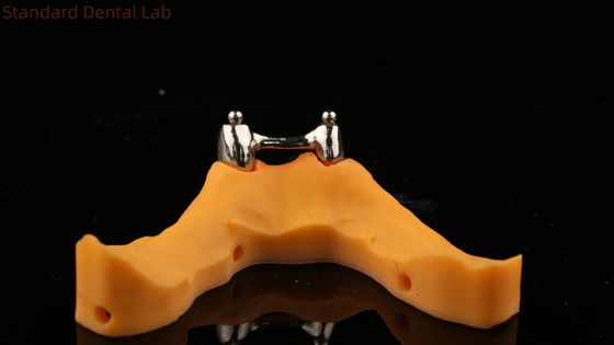 イボクラール デジタル 歯科インプラント 付属品付き 歯入れ 完全アクリルチタンインプラント付き 歯入れ