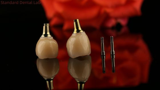 ポルセランジルコニアセメント 固定螺栓インプラント カスタムフィット エステティックのための六角形ヘッド形