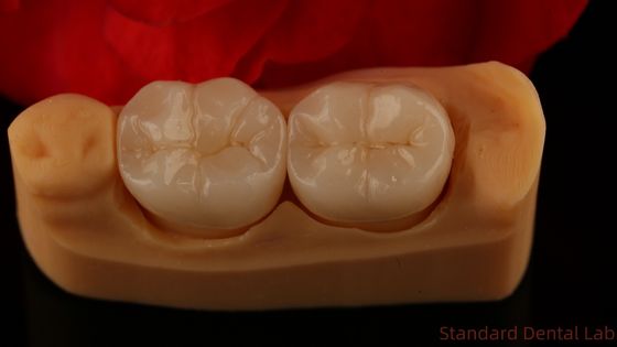 全コントールのジルコニアの冠 特殊な強さと美学 ポーセリアンの覆いなし 後ろの冠 中国歯科研究室