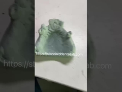 歯科専門家のためのコ-Cr金属部分歯入れ枠