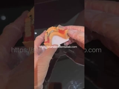 高エステティクス 透明なクラップとアクリル歯のアクリル部分歯入れ 中国歯科ラボ