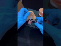 明確なフレームワーク アクリル金属 部分歯入れフレームワーク 高級エステティック 中国歯科ラボ