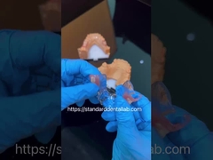 FDA コバルト クロム 高 エステティック クリア フレーム 部分