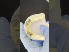 メタル 鋳造 柱 核 クラウン コック 精密 保持 完全 ジルコニア ブルーキッサー