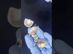 非常に良いステッカーでカスタマイズ可能なコバルトクロム鋳型フレーム