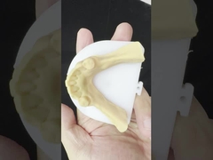 メタル合金 部分 コバルト クロム 歯入れ イボクラール・シェフター 快適な金属フレームワーク