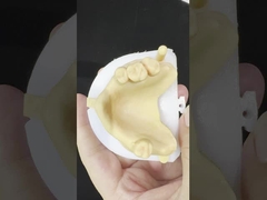 メタル合金 部分 コバルト クロム 歯入れ イボクラール・シェフター 快適な金属フレームワーク