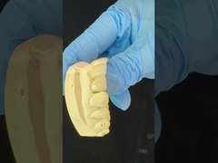 フルコントールジルコニアクラウン/高美容性 天然 オーダーメイド アイドイト ジルコニア 歯科 橋