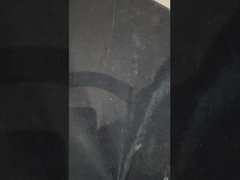 タイタンインプラント サポートされた歯入れ プリキュア イボクラ歯入れ インプラント