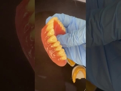 完全 上下 スタイプレート アクリル 部分歯入れ イボクラ歯 ピンクゴム